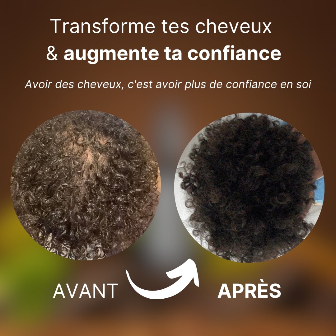 Sérum de Romarin : Cheveux et Barbe Plus Denses en 30 Jours