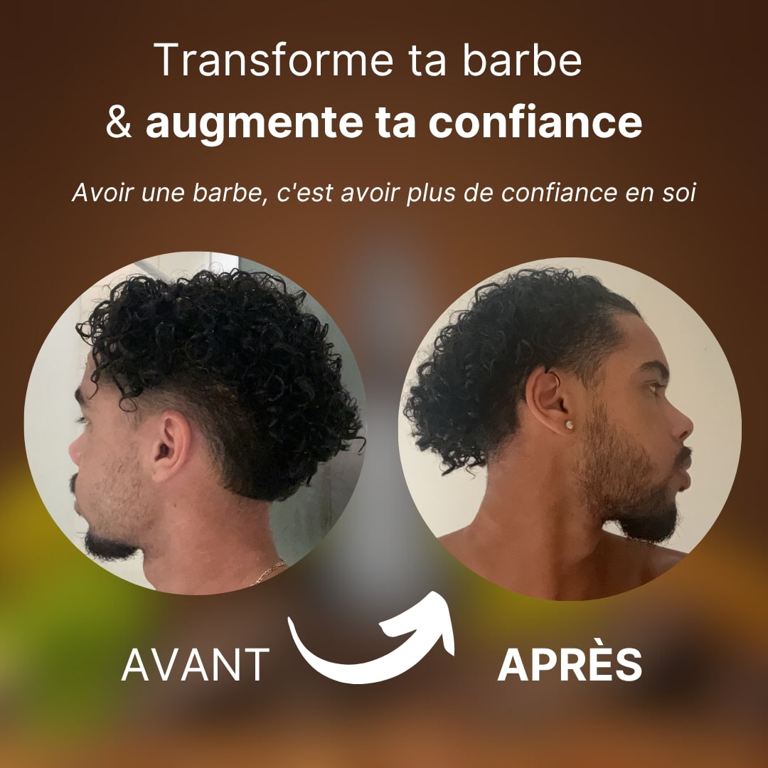 Sérum de Romarin : Cheveux et Barbe Plus Denses en 30 Jours